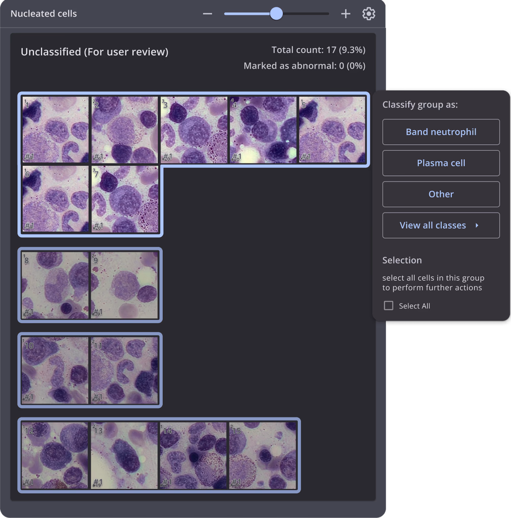 Row-based breakdown view
